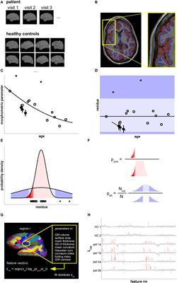 A Fully Automated Pipeline for Normative Atrophy in Patients with Neurodegenerative Disease